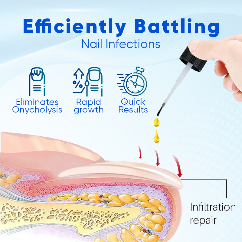 Biancat™ OnyxoGuard Nail Growth and Repair Serum (A)