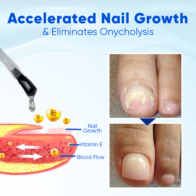 Biancat™ OnyxoGuard Nail Growth and Repair Serum (A)