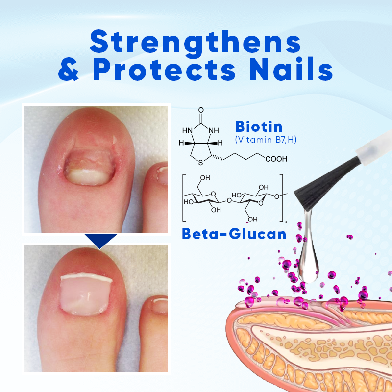 Biancat™ OnyxoGuard Nail Growth and Repair Serum (A)