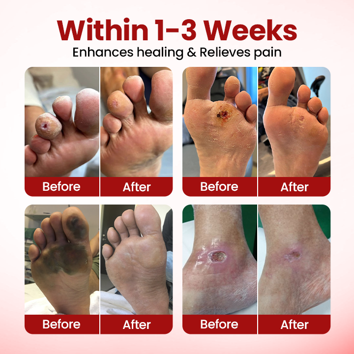 Timilk® VitaGluco Diabetic Care Cream (A)