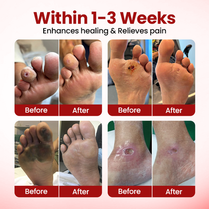 Timilk® VitaGluco Diabetic Care Cream (A)