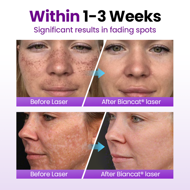 Biancat® SpotErase Probiotic Shield Serum (A)