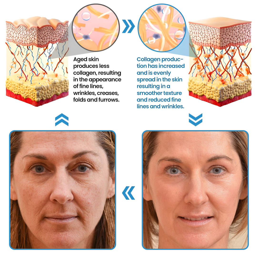 Biancat® Collagen Peptide Serum (A)