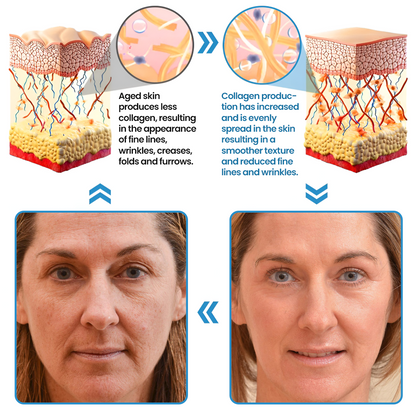 Biancat® Collagen Peptide Serum (A)