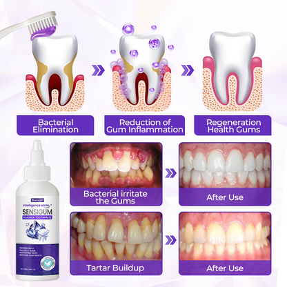 Biancat® SensiGum Fluoride Toothpaste（A）