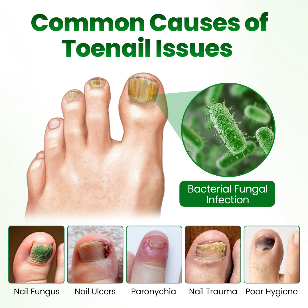 Timilk® HerbaNail 7-Day Repair Serum 🔥 FDA Certified (Clinically Proven Herbal Formula for 7-Day Nail Fungus Repair & Strength Restoration 🌿)