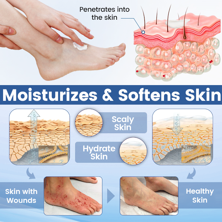 Timilk® AngioVita Diabetic Care Spray (A)