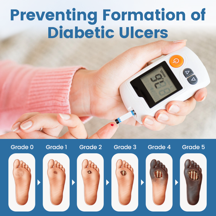 Timilk® AngioVita Diabetic Care Spray (A)