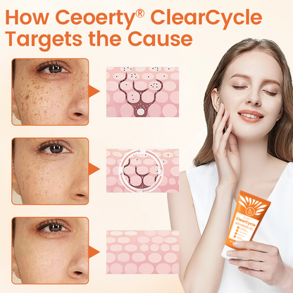 Ceoerty® ClearCycle Skin Renewal Gel