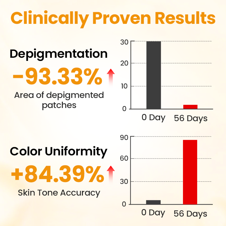 Timilk® VitiGone Rapid Spray — 2–3 Week Repigmentation with OTDS