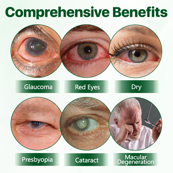 Biancat® Vision Enhancing Multifunctional Eye Drops-(A)