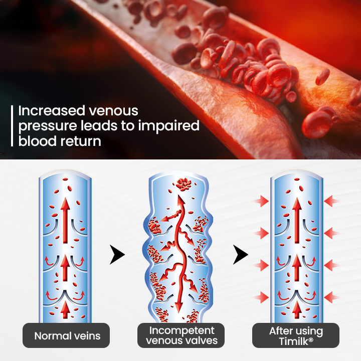 Czticle® Leg Vein Magnet Ankle Bracelet