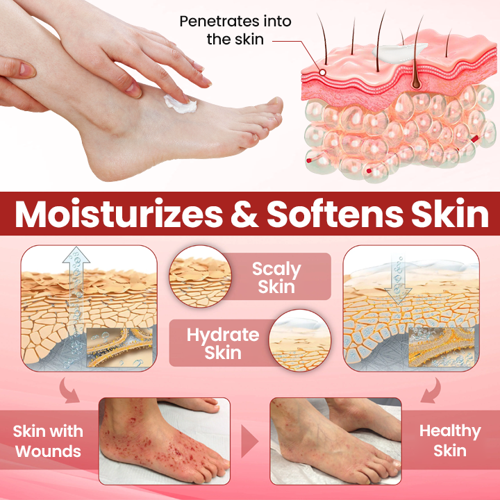 Timilk® VitaGluco Diabetic Care Cream (A)