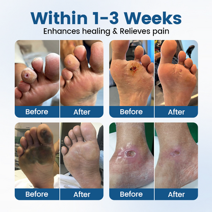 Timilk® AngioVita Diabetic Care Spray (A)