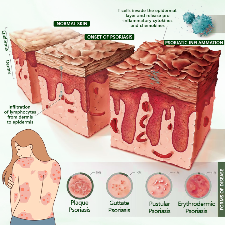 Timilk® DermaPure Tea Tree Healing Cream