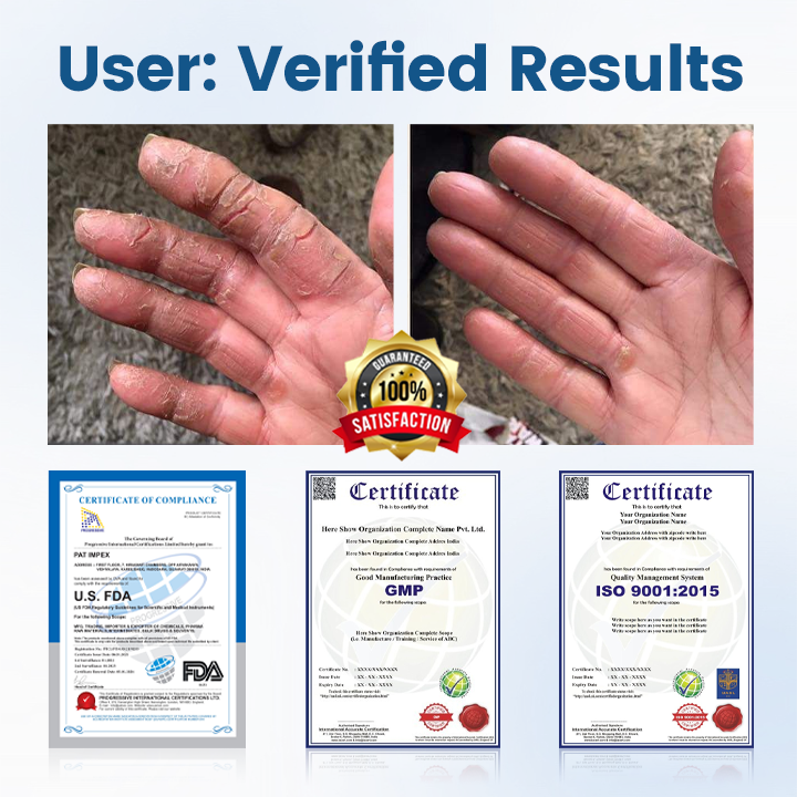 Timilk® AngioVita Diabetic Care Spray (A)