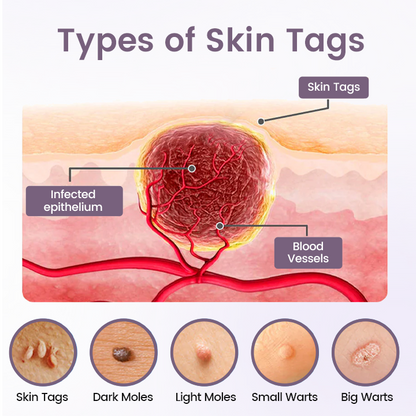 Ceoerty® WartSmooth Renewal Serum