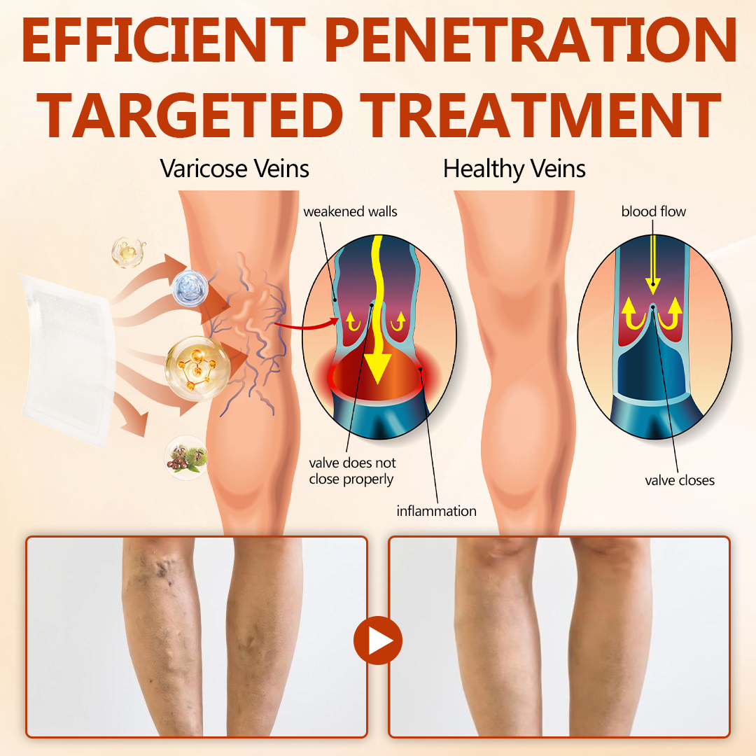 Timilk® VeinRepair Microneedle Patch Roll