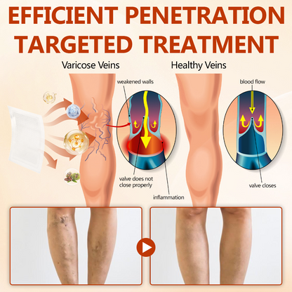 Timilk® VeinRepair Microneedle Patch Roll