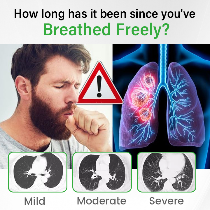 Timilk® Pulmovia Quercetin Lung Detox Inhaler (A)