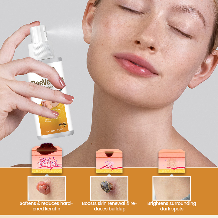 Timilk® BeeVenom Wart Renewal Spray (A)