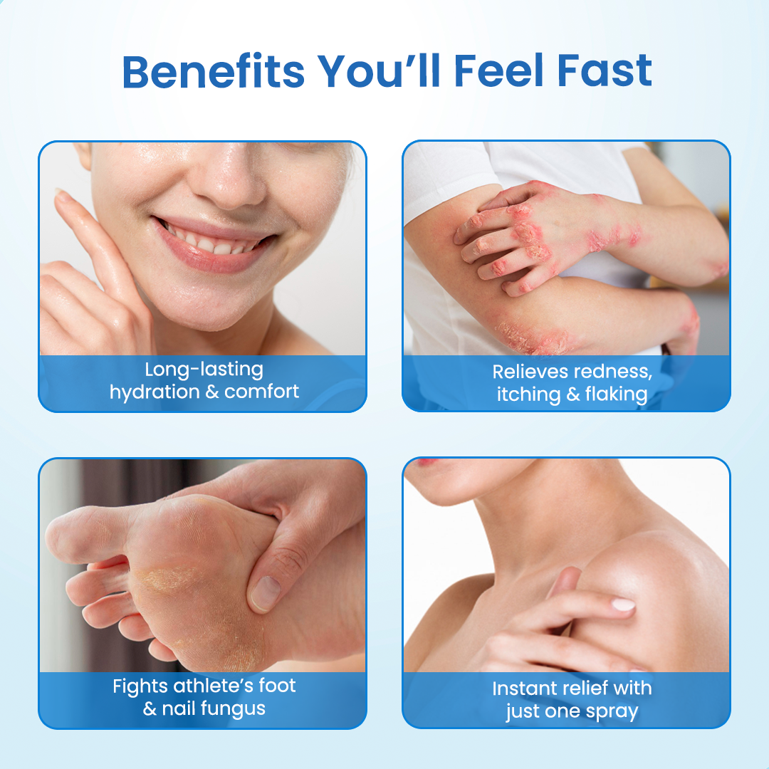 Timilk® MagnesiumHerb Psoriasis Relief Cream (A)