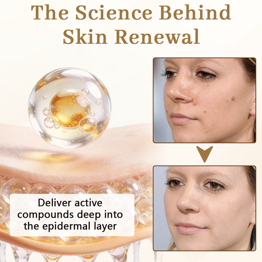 Ceoerty® KeraClear Pro Multi-Action Renewal Cream🌾✨（A）