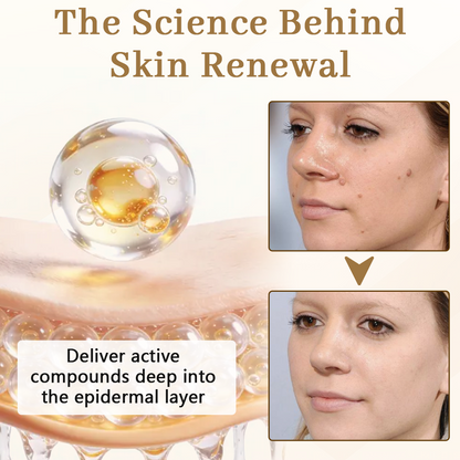 Ceoerty® KeraClear Pro Multi-Action Renewal Cream🌾✨（A）