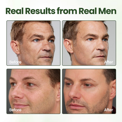 Biancat® FortiTallow Anti-Wrinkle Balm