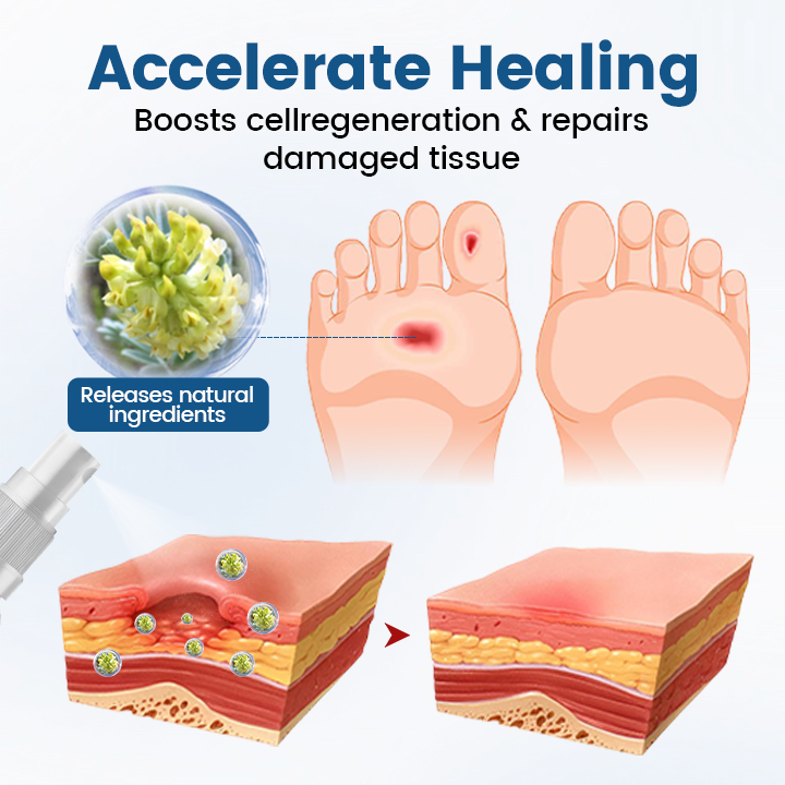 Timilk® AngioVita Diabetic Care Spray (A)