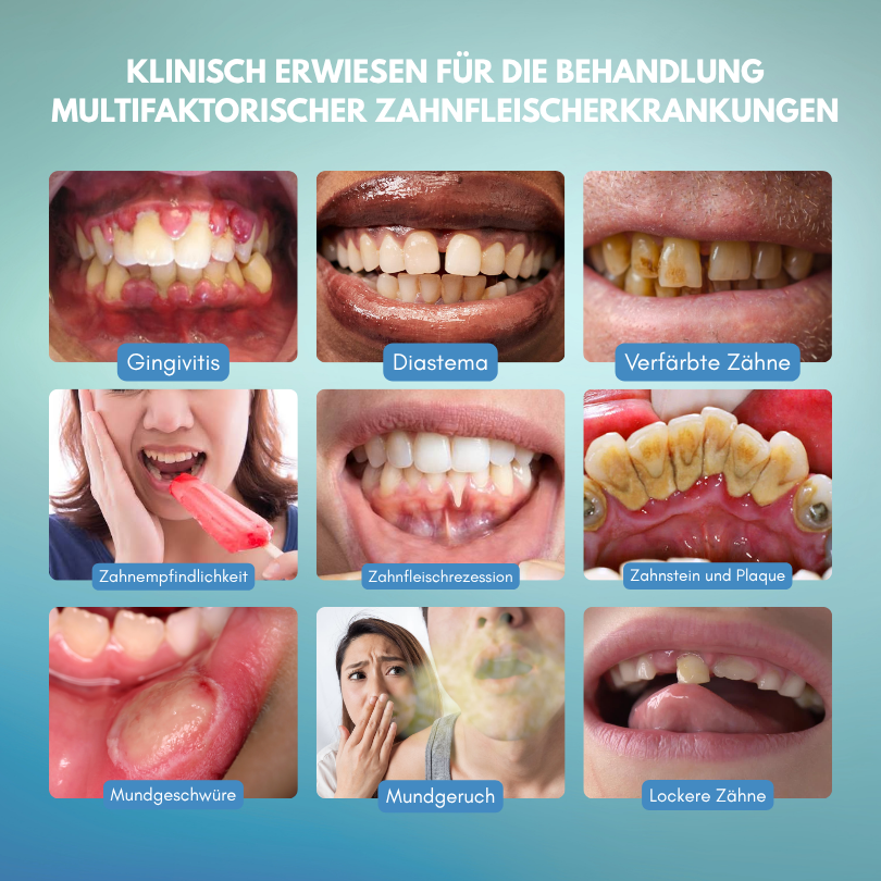 Timilk® GumRescue Precision Gel for Loose Teeth & Bleeding Gums