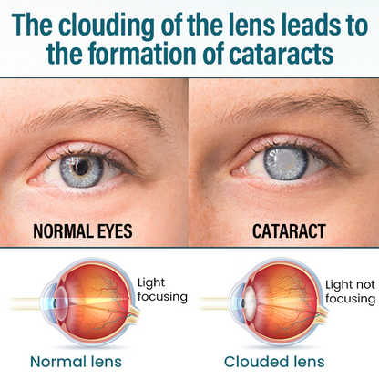 Timilk® OptiRegen Nano Eye Serum