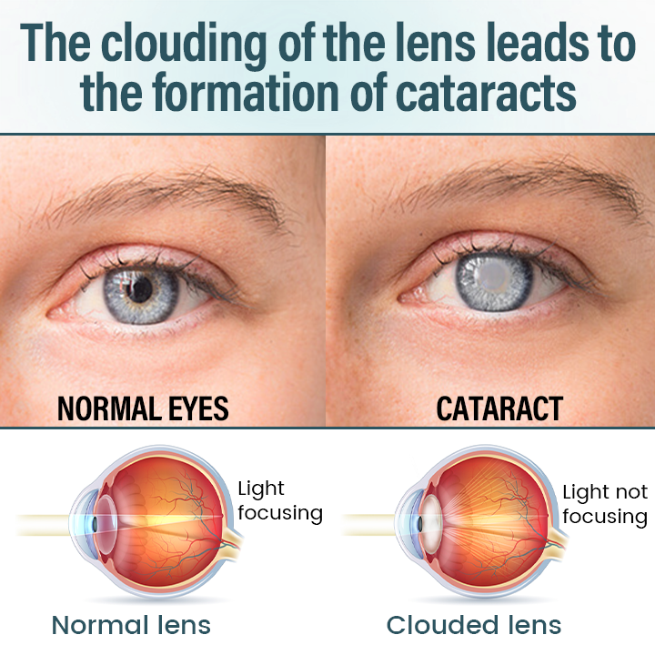 Timilk® OptiFusion Nano Eye Drops Serum