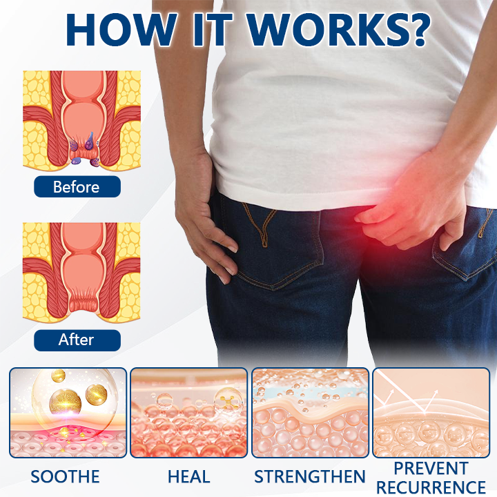 Timilk® HemoRelief Herbal Spray (A)