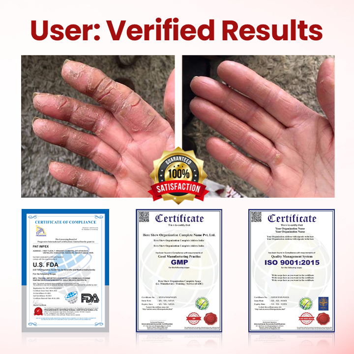 Timilk® VitaGluco Diabetic Care Cream (A)