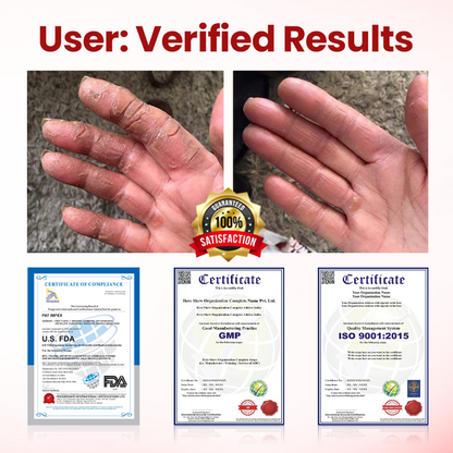 Timilk® VitaGluco Diabetic Care Cream (A)