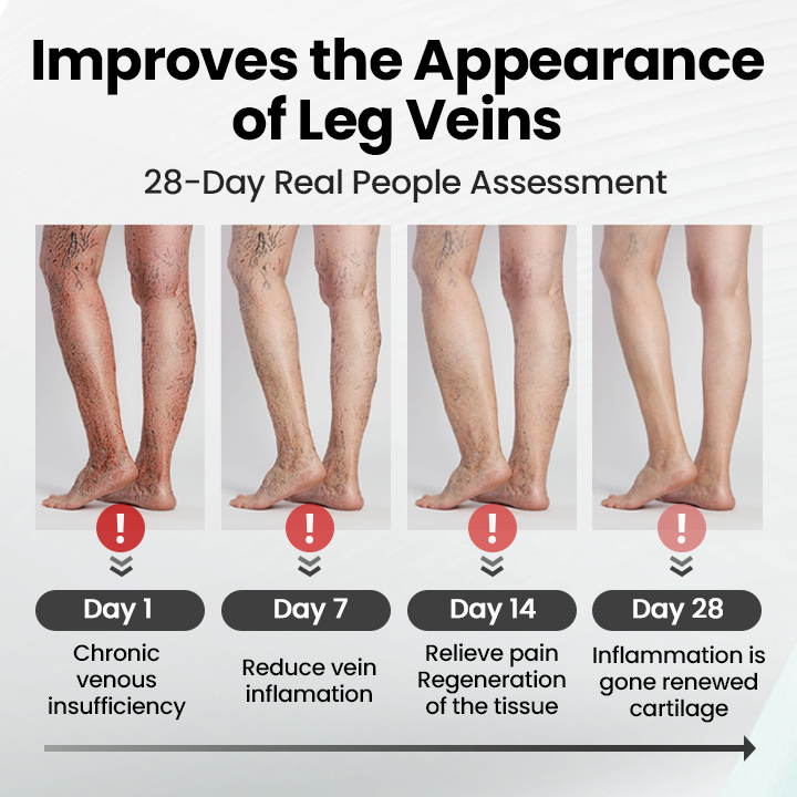 Czticle® Leg Vein Magnet Ankle Bracelet