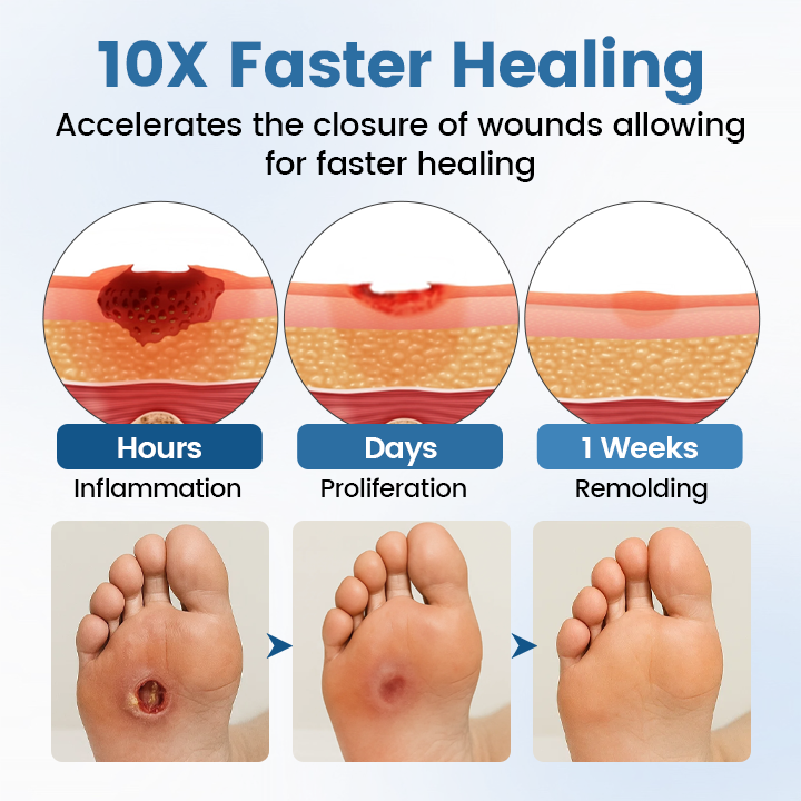 Timilk® AngioVita Diabetic Care Spray (A)