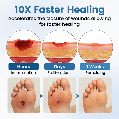 Timilk® AngioVita Diabetic Care Spray (A)