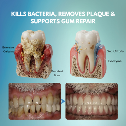 Timilk® GumRescue Precision Gel for Loose Teeth & Bleeding Gums