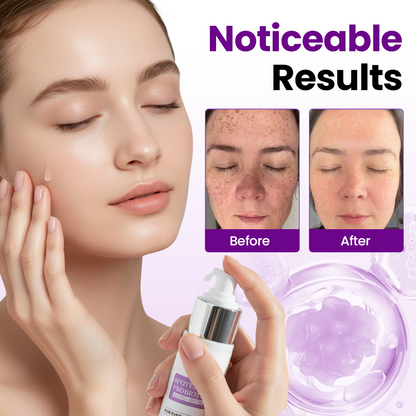 Biancat® SpotErase Probiotic Shield Serum