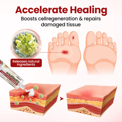 Timilk® VitaGluco Diabetic Care Cream (A)