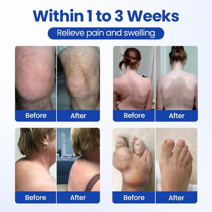 Timilk® BPC-157 Joint&Bone Repair Roll-On Gel