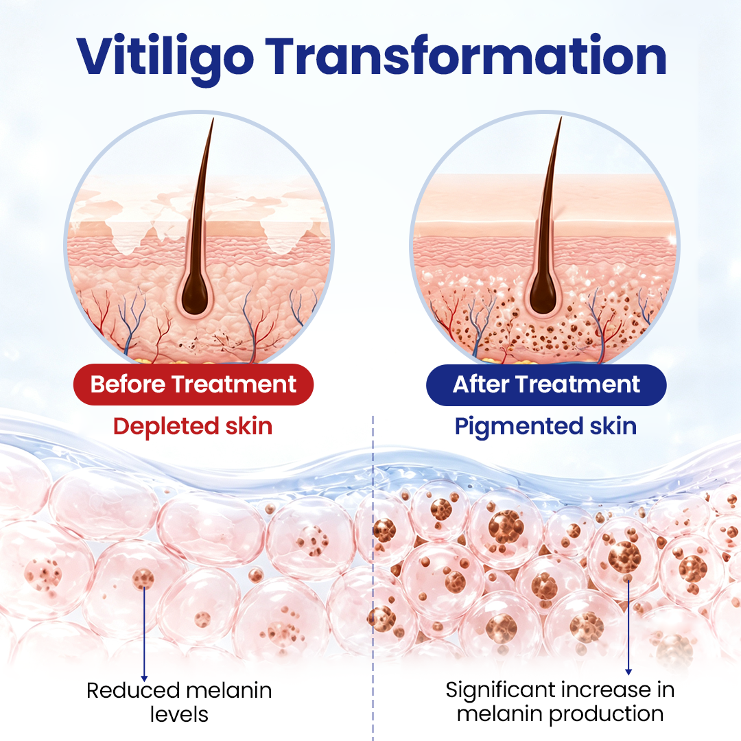 Biancat® VitiRepair Advanced Spray (A)