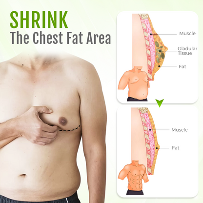 Biancat™ ChestFlex Turmeric Gynecomastia Patch -(A)
