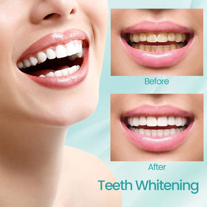 Ceoerty® RadiantSmile Oral Rinse (A)